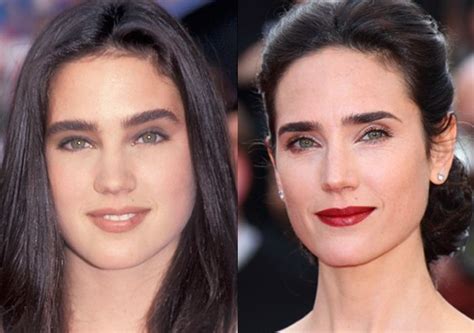 jennifer connelly plastic surgery